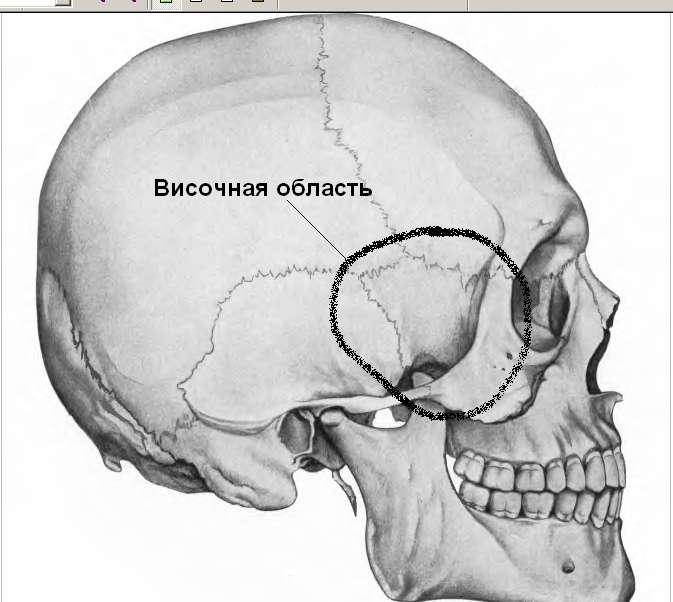 Можно ли ум. Смерть от удара в висок.