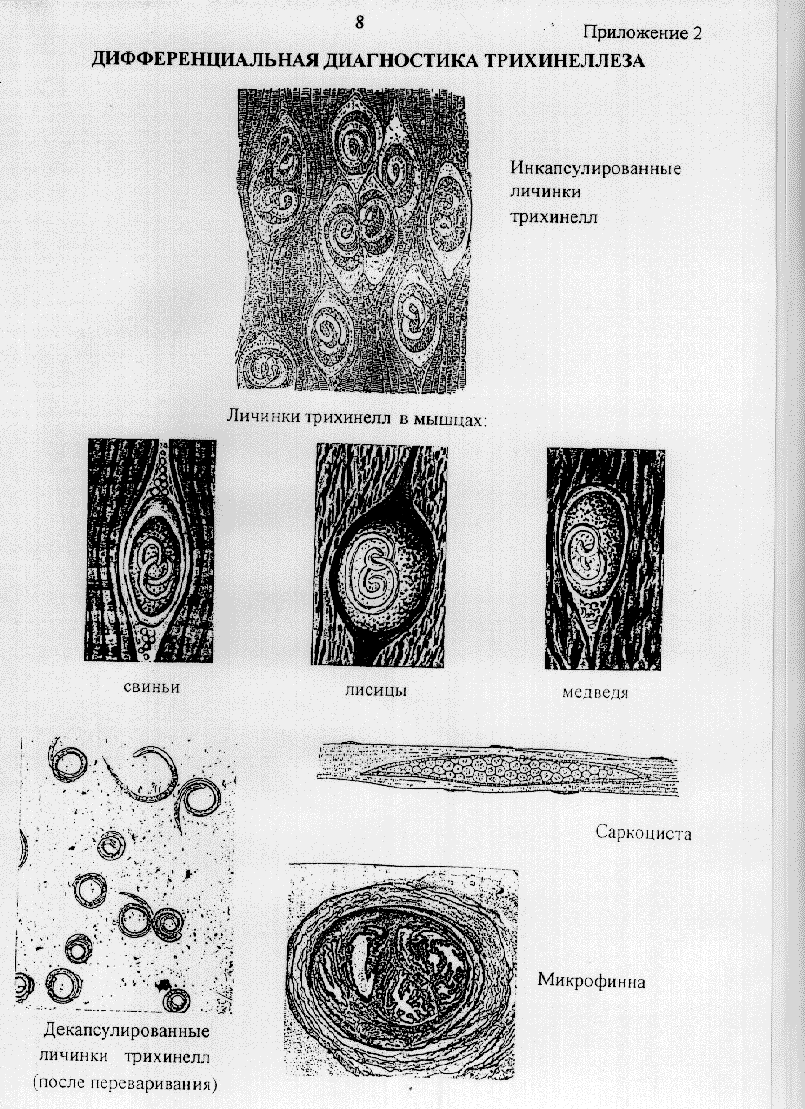 Анализ на трихинеллез. Инкапсулированные личинки трихинеллы в мышечной ткани. Инкапсулированная личинка трихинеллы. Трихинелла лабораторная диагностика. Трихинеллоскопия дифференциальная диагностика.