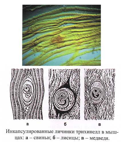Инкапсулированные личинки трихинеллы в мышцах рисунок с обозначениями