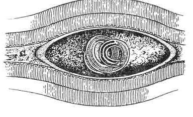 Личинка трихинеллы рисунок