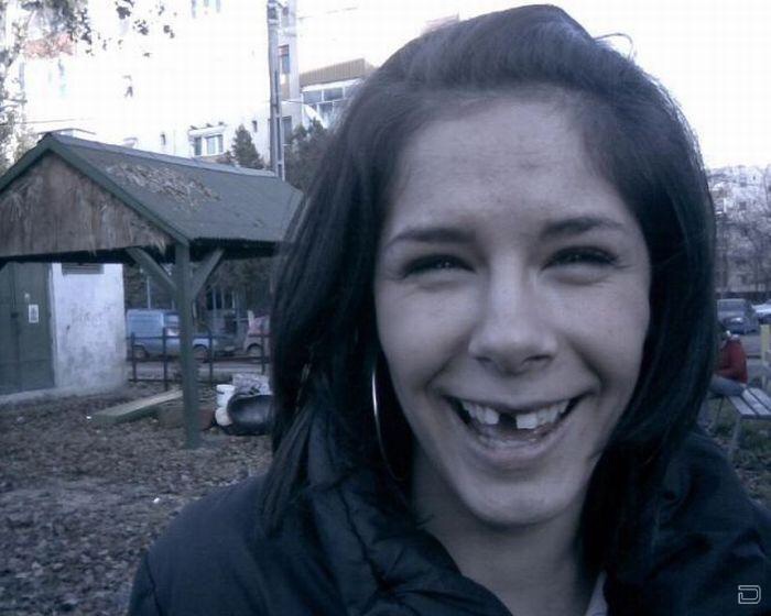 Девушка без переднего зуба. Улыбки знаменитостей. Женщина с большими зубами. Энн хэтэуэй зубы. Беззубыезубые девушки.