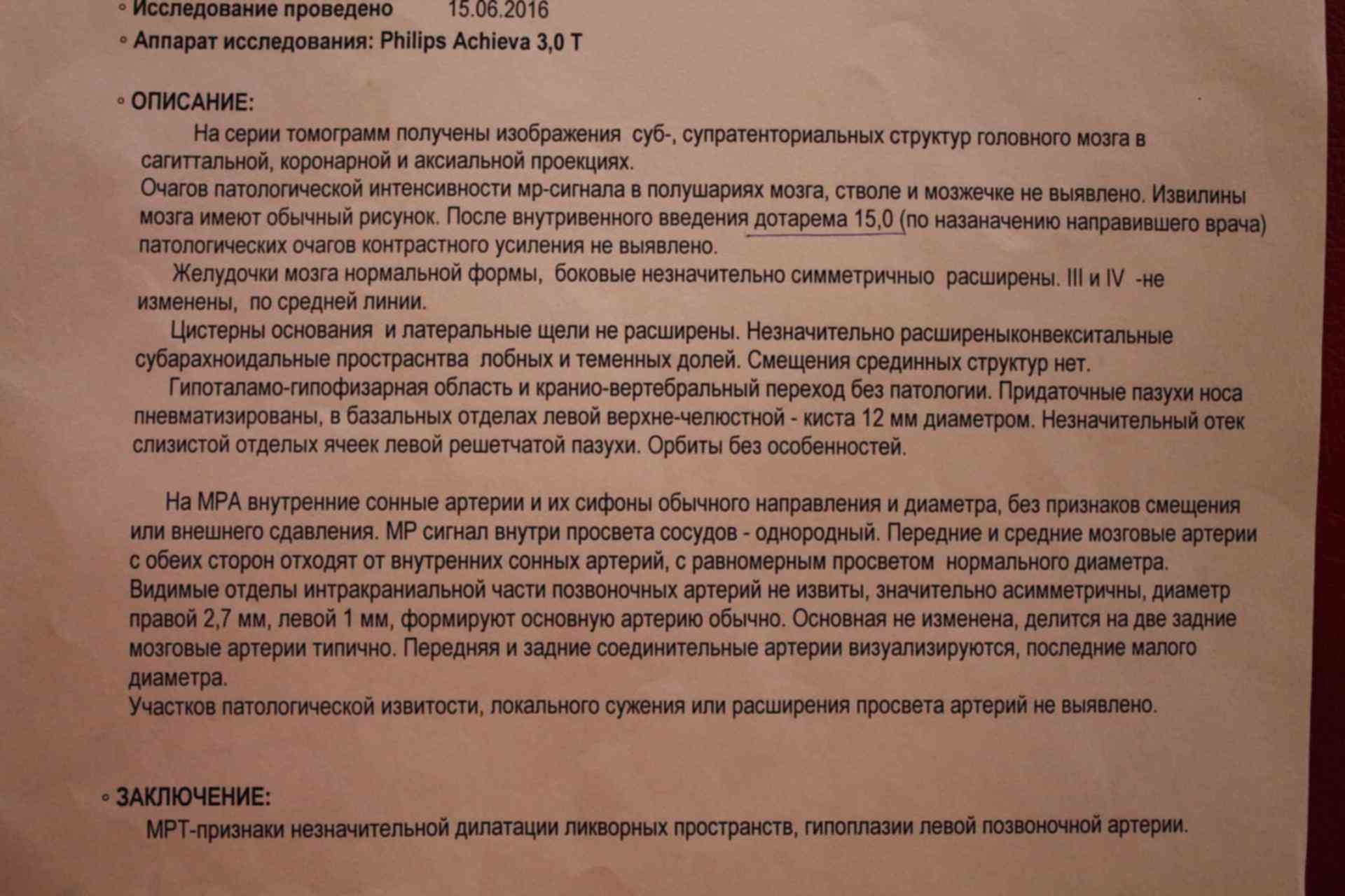 Гипоплазия правой. Гипоплазия правой позвоночной артерии. Диаметр позвоночной артерии при гипоплазии. Гипоплазия позвоночной артерии на УЗИ. Гипоплазия позвоночной артерии диаметр.