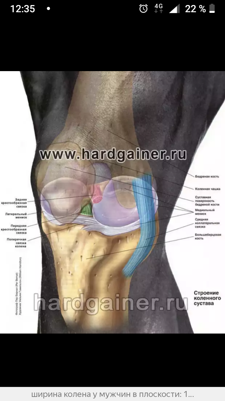 Болит колено сбоку. Болит косточка под коленом сбоку с внутренней стороны. Коленный сустав анатомия боль. Внутренняя сторона колена. Болит внутренняя часть колена.