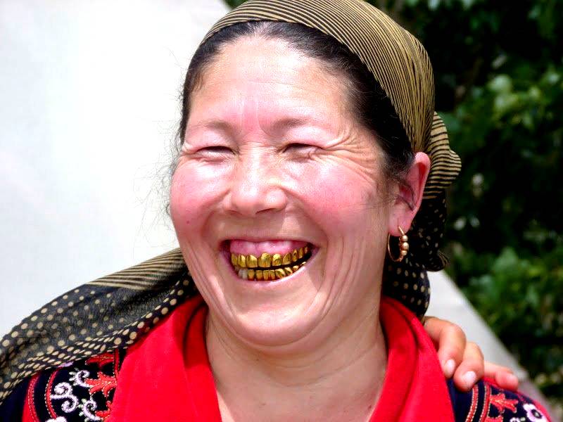 Золотые зубы фото узбекистан