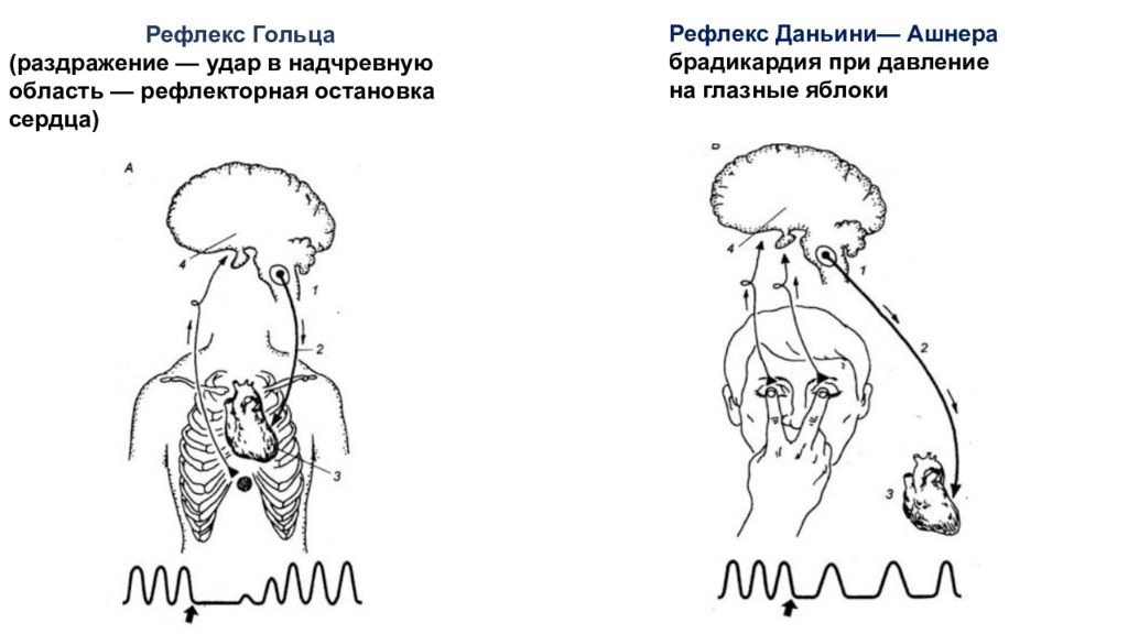 Рефлекс парина схема