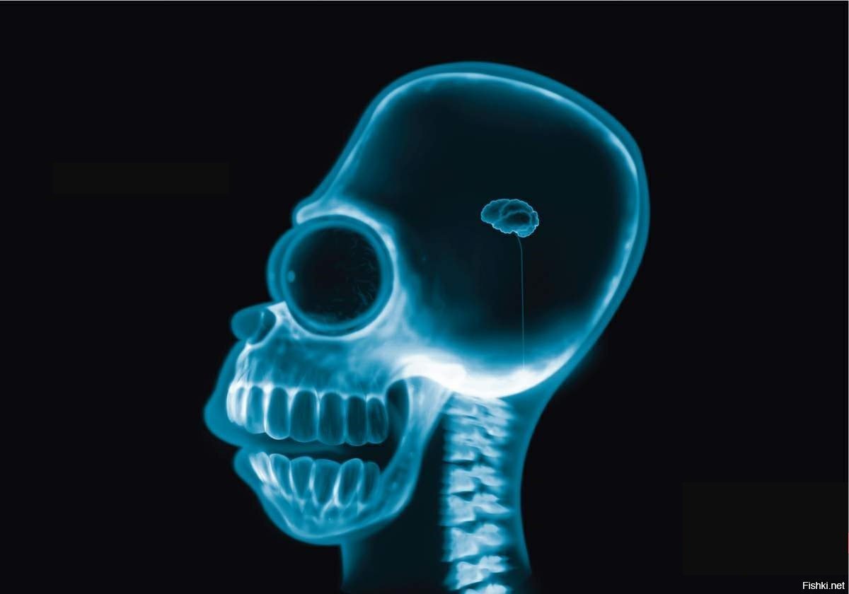 Головной мозг в черепной коробке. Мозг без черепа. Скелет человека мозг. Головной мозг в черепной коробке. Череп современного человека.